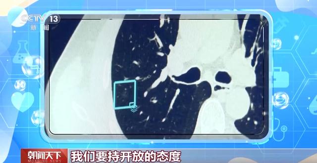 “AI醫(yī)生”能取代醫(yī)生嗎？聽聽醫(yī)藥科技專家學(xué)者怎么說