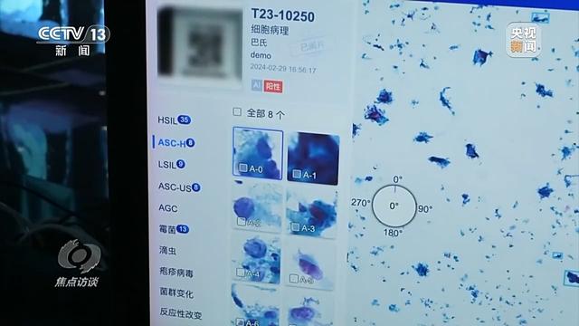 焦點(diǎn)訪談丨輔助診斷、AI問答、健康管理……AI正重塑醫(yī)療服務(wù)鏈條